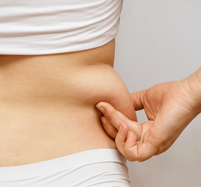 Fat Reduction Treatment Ahmedabad
