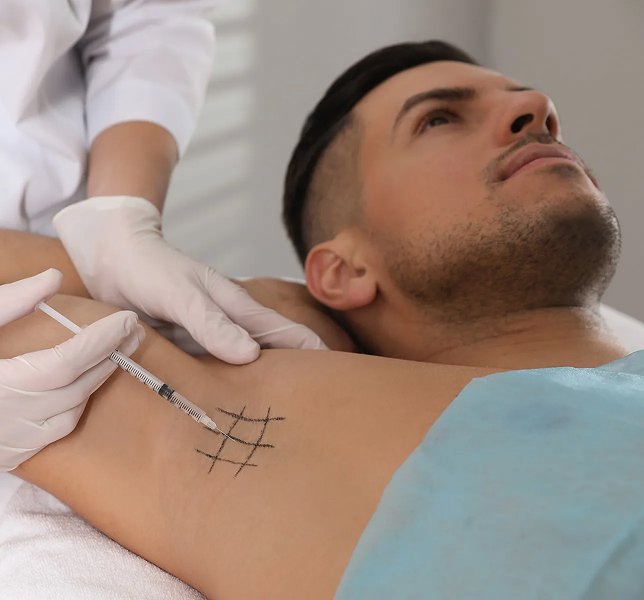 Hyperhidrosis Treatment Ahmedabad