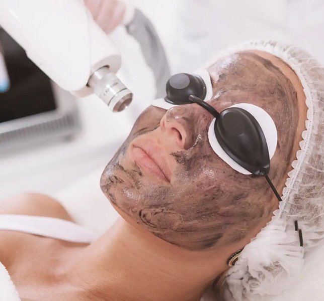 Laser Toning Carbon Toning Ahmedabad