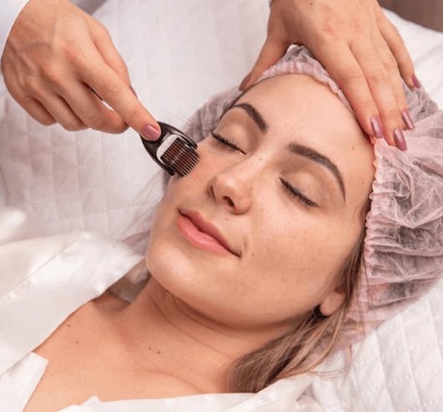 Microneedling Treatment Ahmedabad
