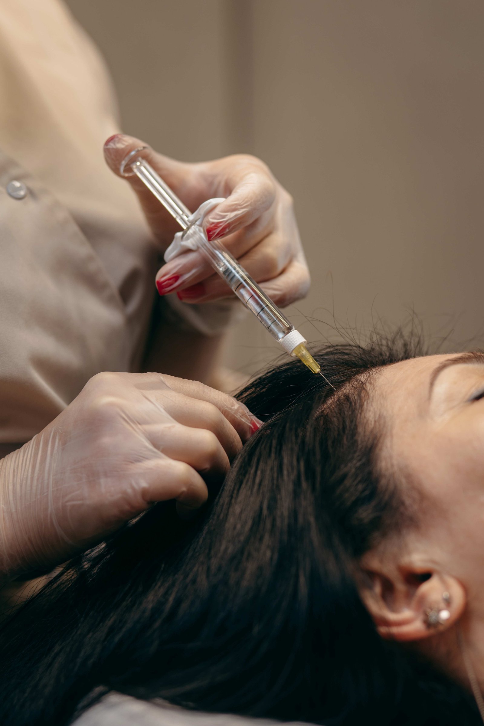 PRP Hair Treatment in Indore