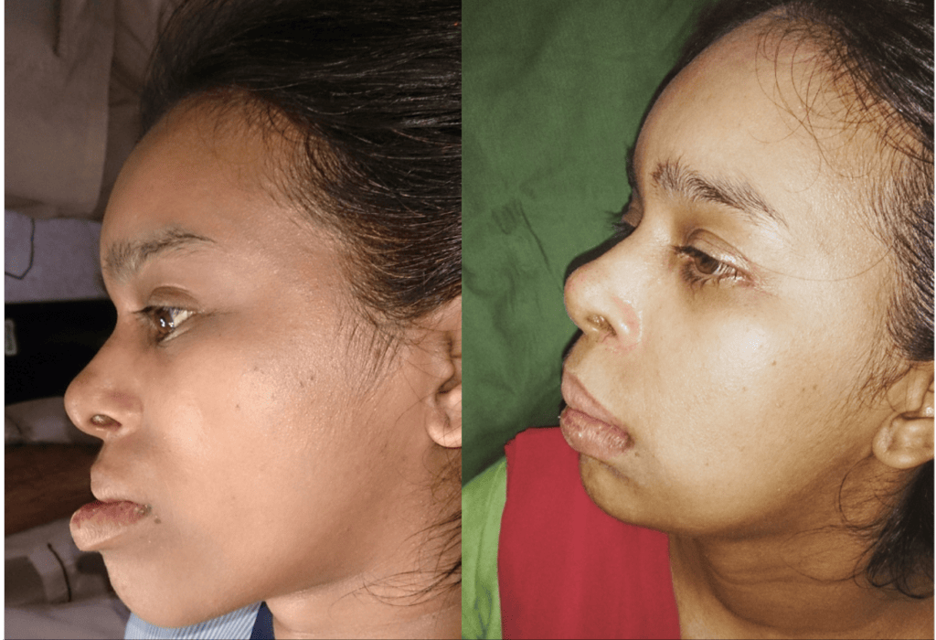 jaw-and-Chin-Surgeon-in-Navi-Mumbai-1024x887 (1)