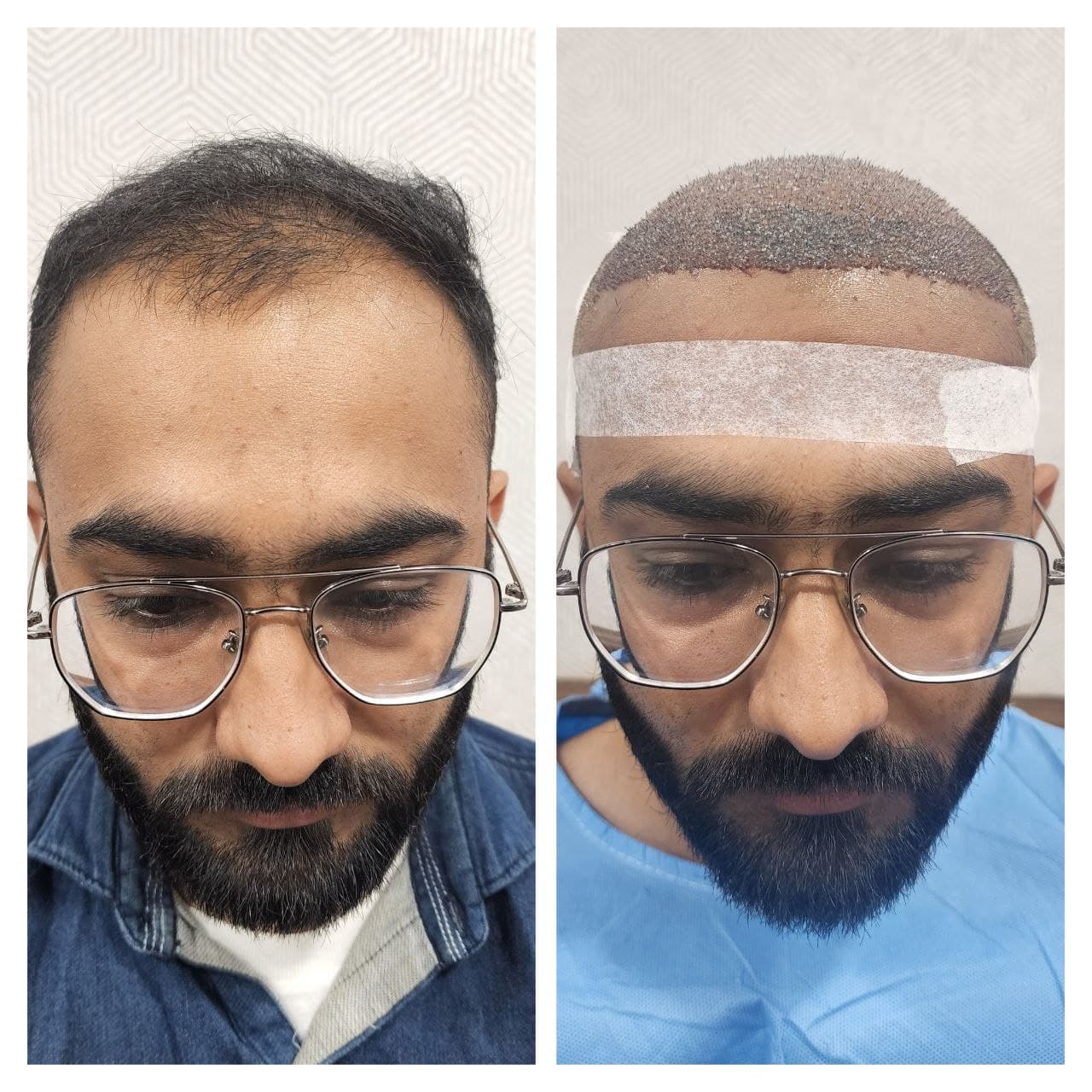 Hair treatment results